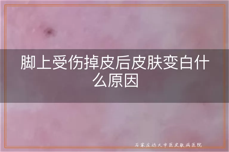 脚上受伤掉皮后皮肤变白什么原因