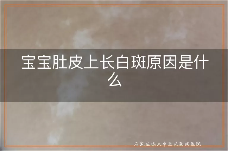 宝宝肚皮上长白斑原因是什么
