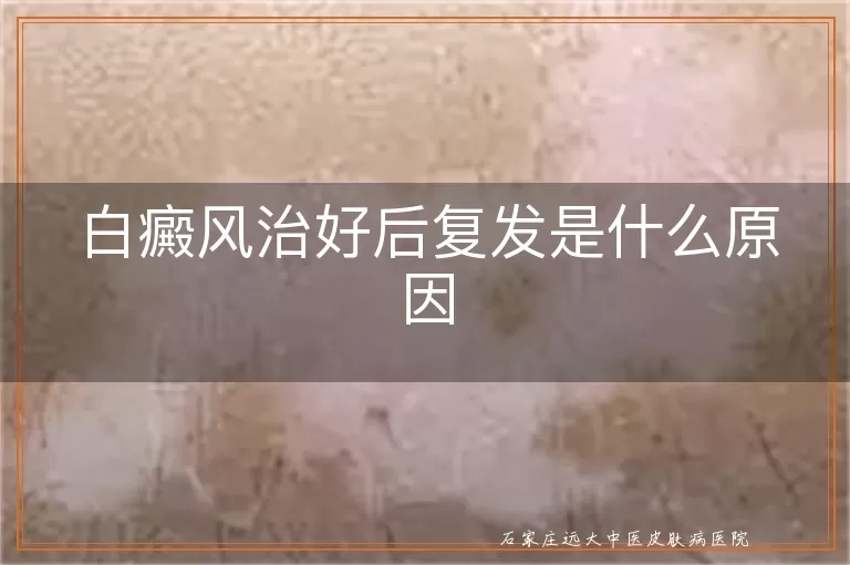 白癜风治好后复发是什么原因