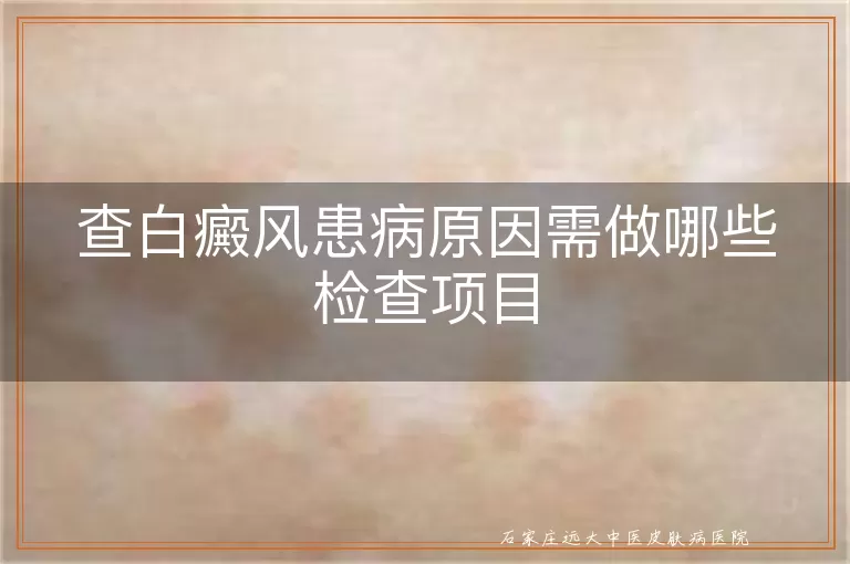 查白癜风患病原因需做哪些检查项目
