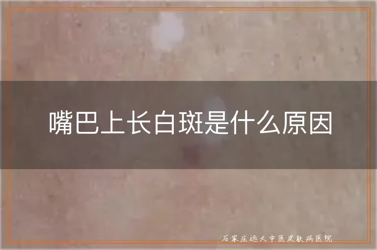 嘴巴上长白斑是什么原因