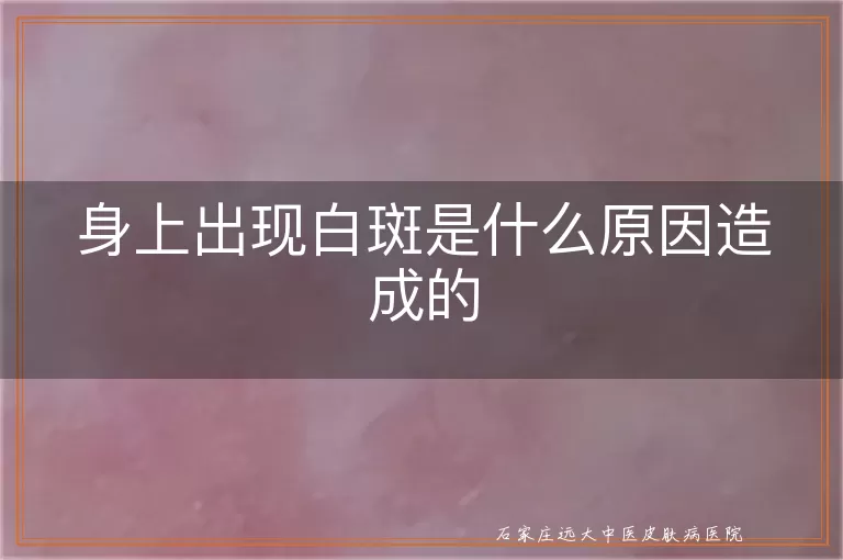 身上出现白斑是什么原因造成的