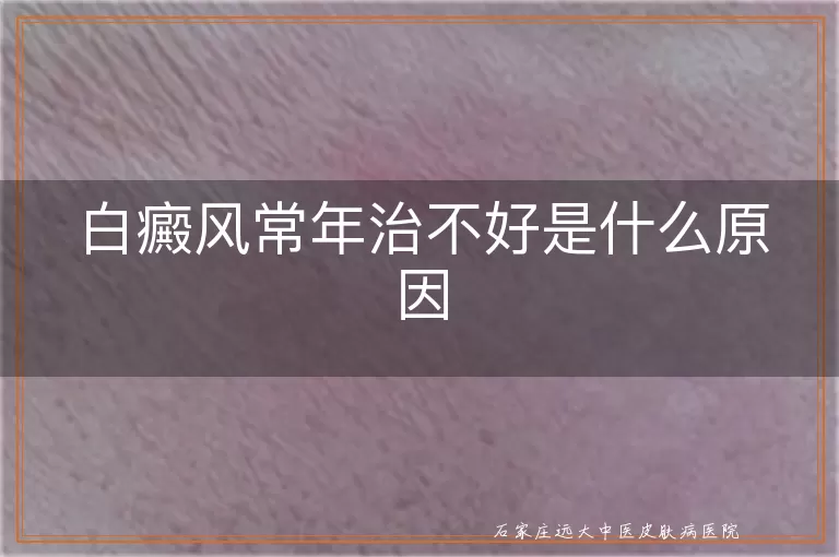 白癜风常年治不好是什么原因
