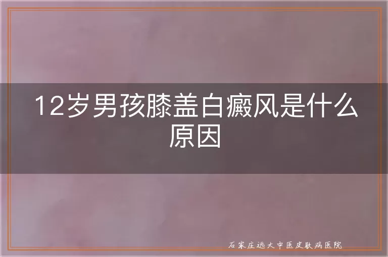 12岁男孩膝盖白癜风是什么原因