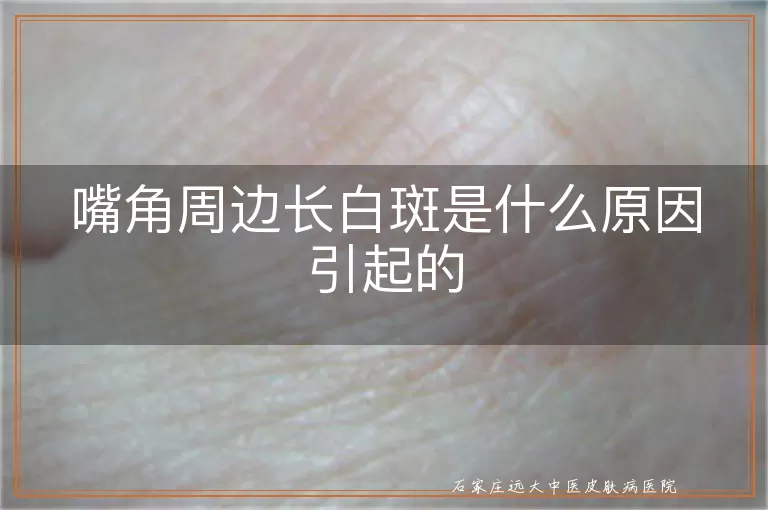 嘴角周边长白斑是什么原因引起的