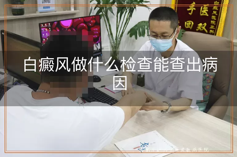 白癜风做什么检查能查出病因