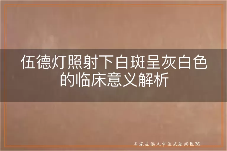 伍德灯照射下白斑呈灰白色的临床意义解析