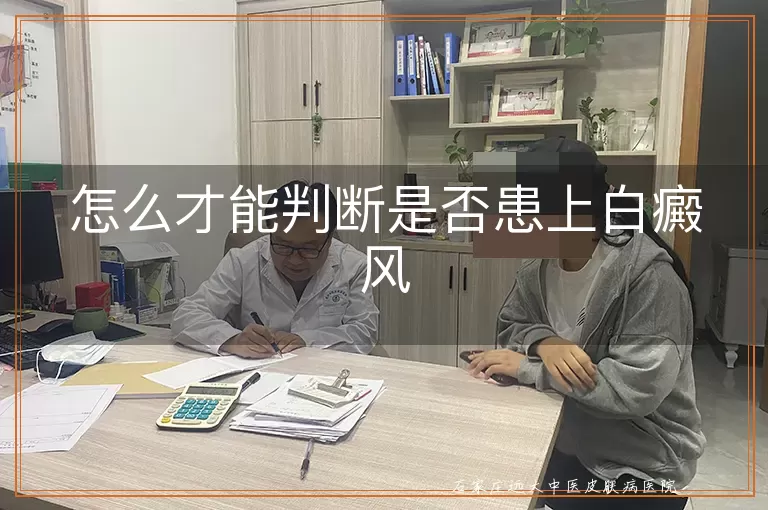 怎么才能判断是否患上白癜风