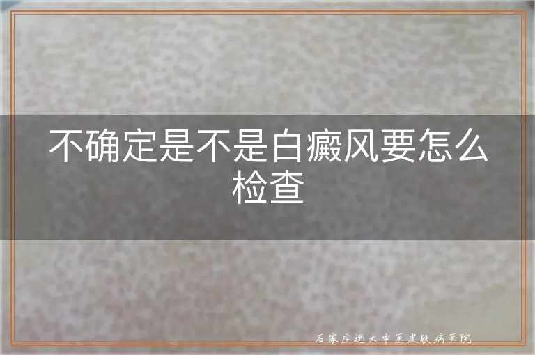 不确定是不是白癜风要怎么检查