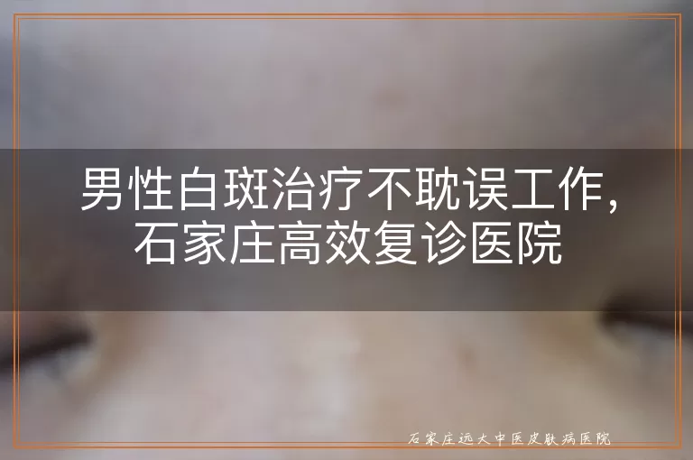 男性白斑治疗不耽误工作，石家庄高效复诊医院