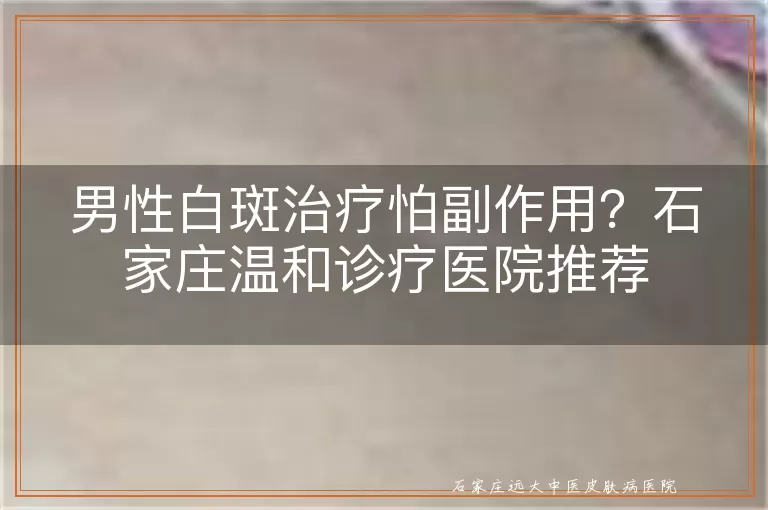 男性白斑治疗怕副作用?石家庄温和诊疗医院推荐