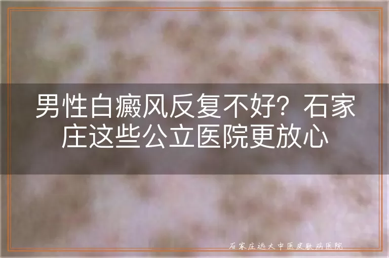男性白癜风反复不好？石家庄这些公立医院更放心