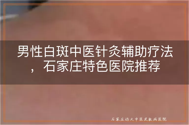 男性白斑中医针灸辅助疗法，石家庄特色医院推荐