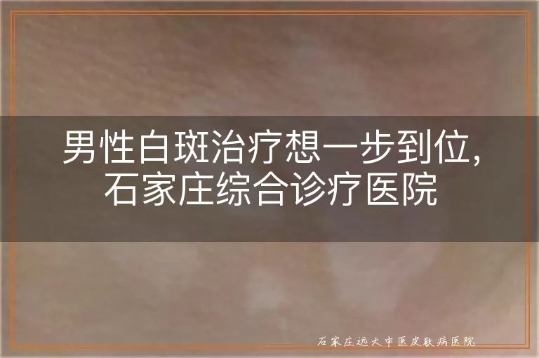 男性白斑治疗想一步到位，石家庄综合诊疗医院