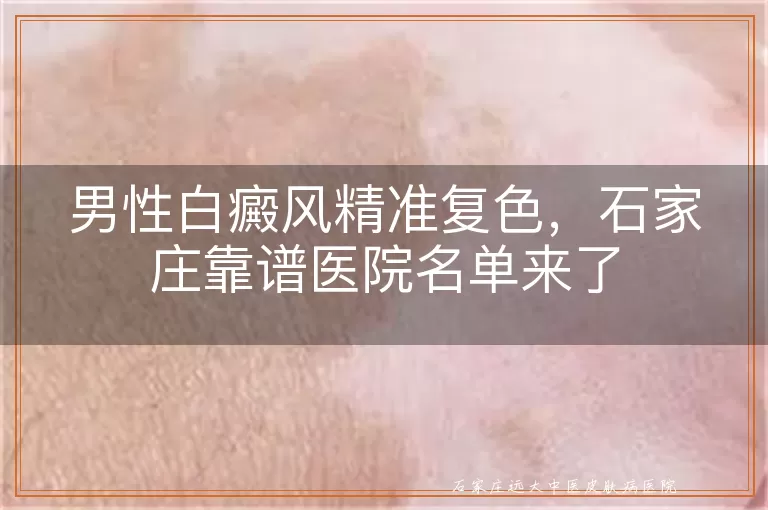 男性白癜风精准复色，石家庄靠谱医院名单来了