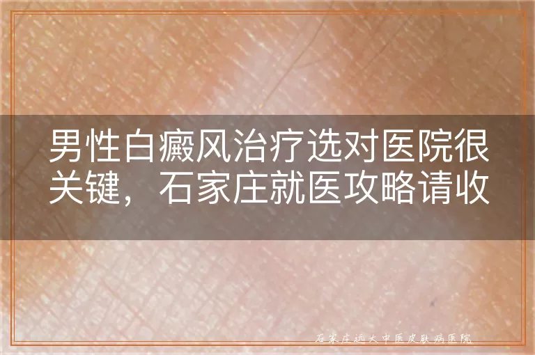 男性白癜风治疗选对医院很关键，石家庄就医攻略请收好