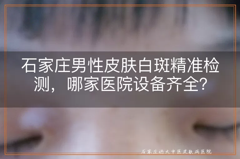 石家庄男性皮肤白斑精准检测，哪家医院设备齐全？