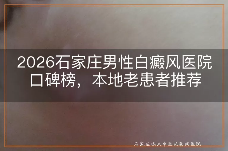 2026石家庄男性白癜风医院口碑榜,本地老患者推荐