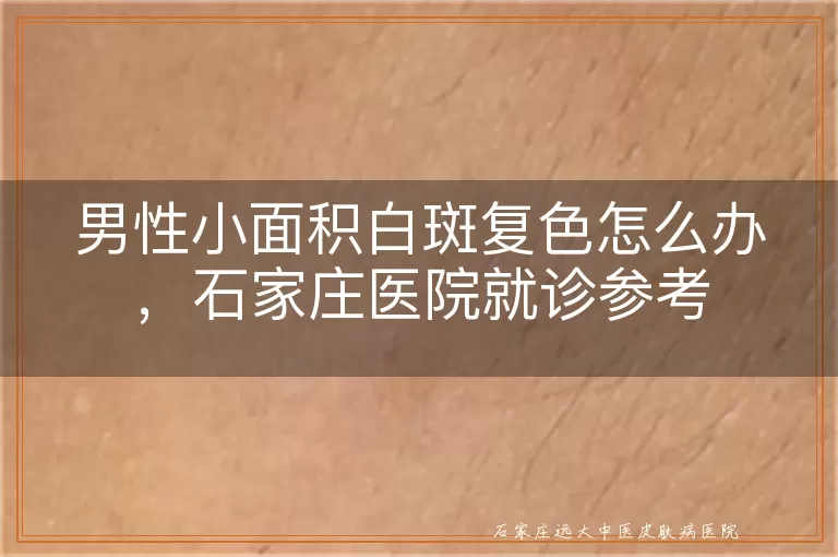 男性小面积白斑复色怎么办,石家庄医院就诊参考