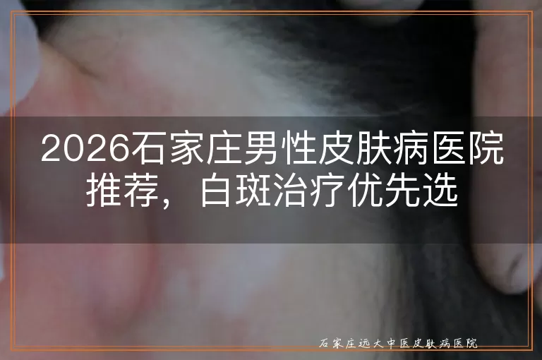 2026石家庄男性皮肤病医院推荐,白斑治疗优先选