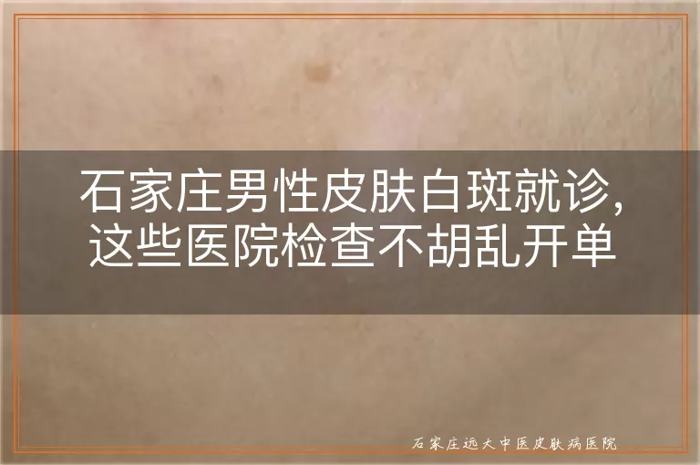 石家庄男性皮肤白斑就诊，这些医院检查不胡乱开单