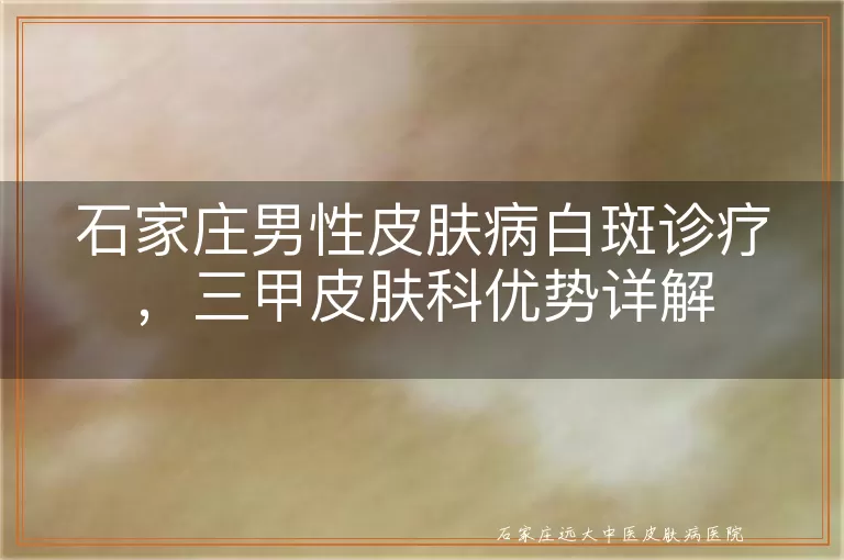 石家庄男性皮肤病白斑诊疗，三甲皮肤科优势详解