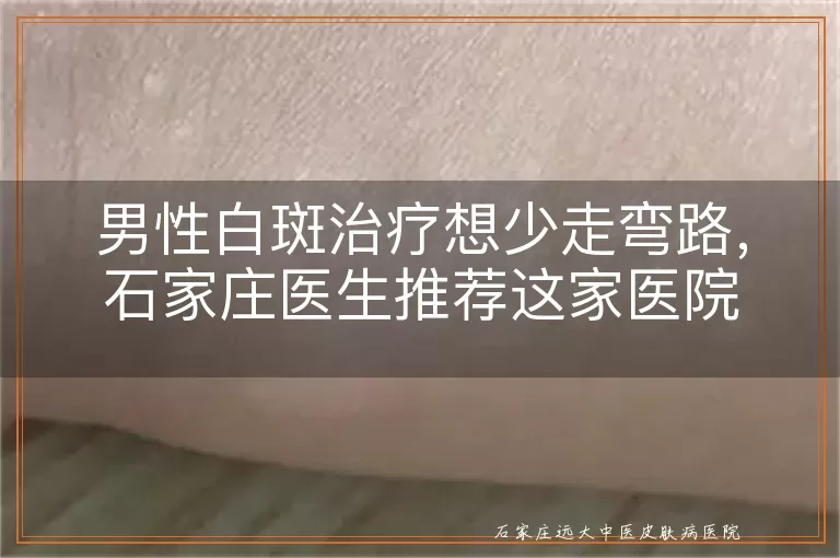 男性白斑治疗想少走弯路，石家庄医生推荐这家医院