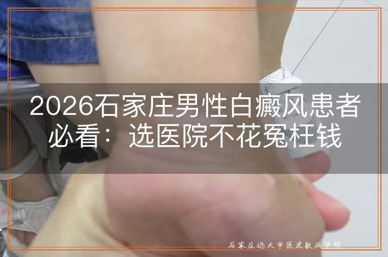 2026石家庄男性白癜风患者必看：选医院不花冤枉钱