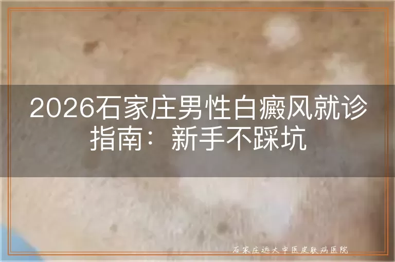 2026石家庄男性白癜风就诊指南：新手不踩坑
