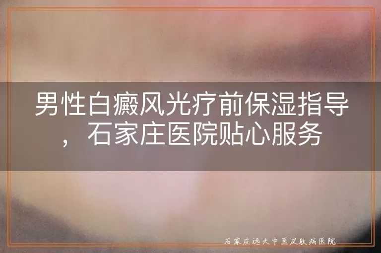 男性白癜风光疗前保湿指导，石家庄医院贴心服务