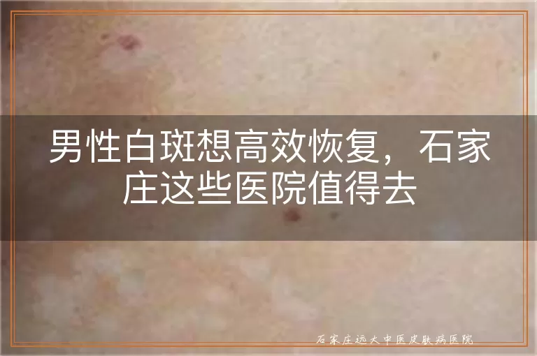 男性白斑想高效恢复，石家庄这些医院值得去