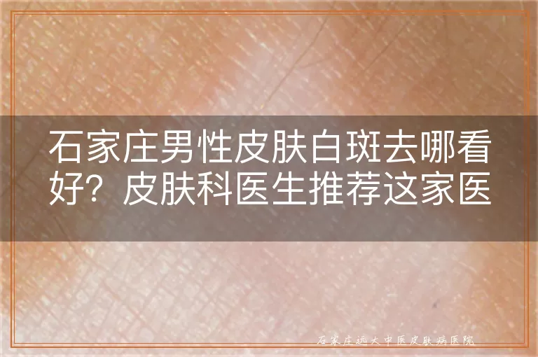 石家庄男性皮肤白斑去哪看好？皮肤科医生推荐这家医院
