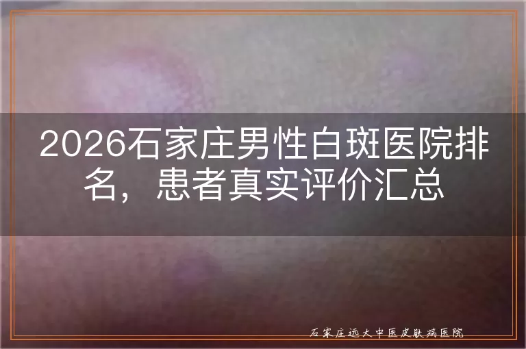 2026石家庄男性白斑医院排名,患者真实评价汇总