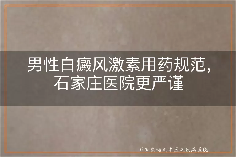 男性白癜风激素用药规范，石家庄医院更严谨