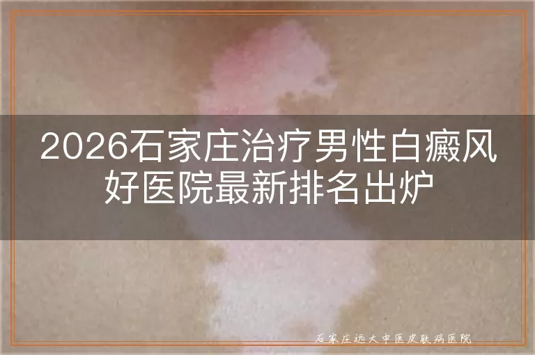 2026石家庄治疗男性白癜风好医院最新排名出炉