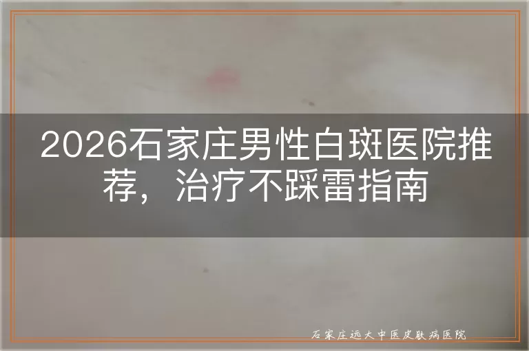 2026石家庄男性白斑医院推荐，治疗不踩雷指南