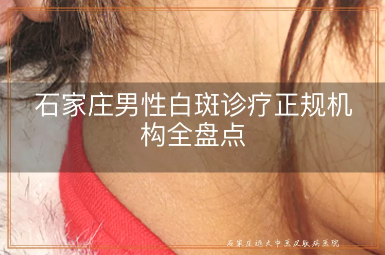 石家庄男性白斑诊疗正规机构全盘点