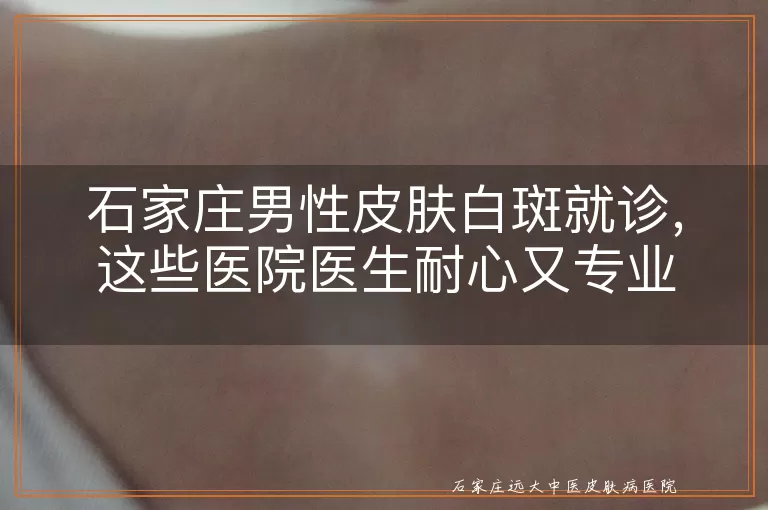 石家庄男性皮肤白斑就诊，这些医院医生耐心又专业
