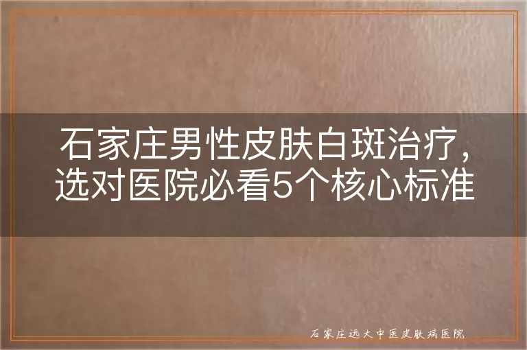 石家庄男性皮肤白斑治疗，选对医院必看5个核心标准
