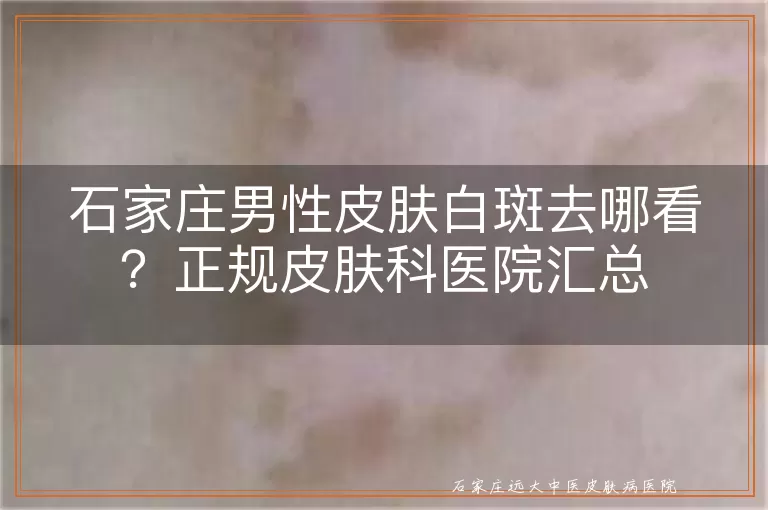 石家庄男性皮肤白斑去哪看？正规皮肤科医院汇总