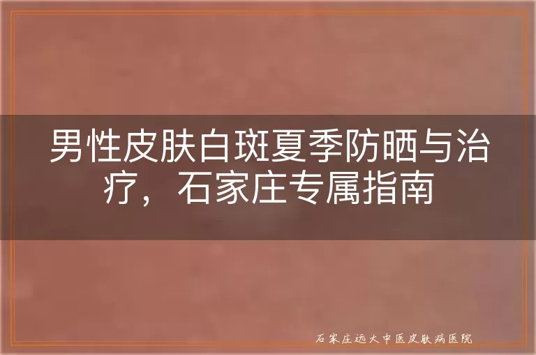 男性皮肤白斑夏季防晒与治疗，石家庄专属指南