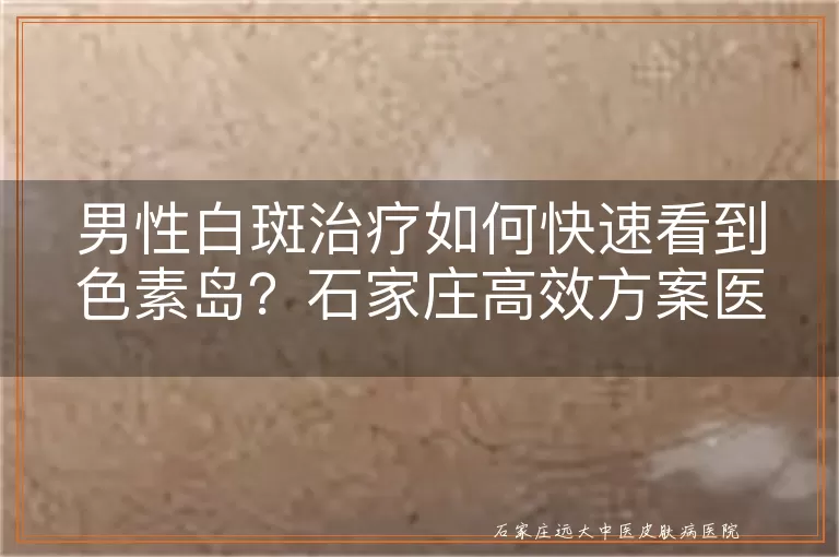 男性白斑治疗如何快速看到色素岛？石家庄高效方案医院解析