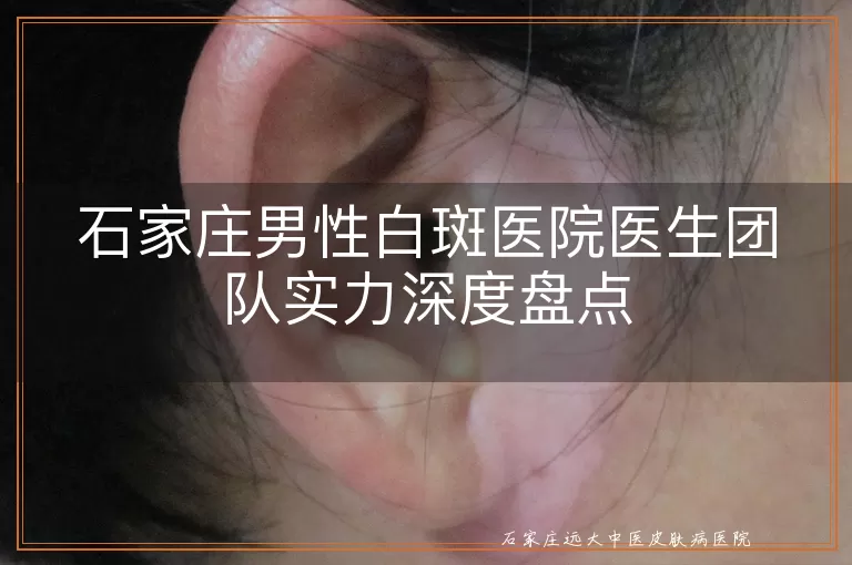 石家庄男性白斑医院医生团队实力深度盘点