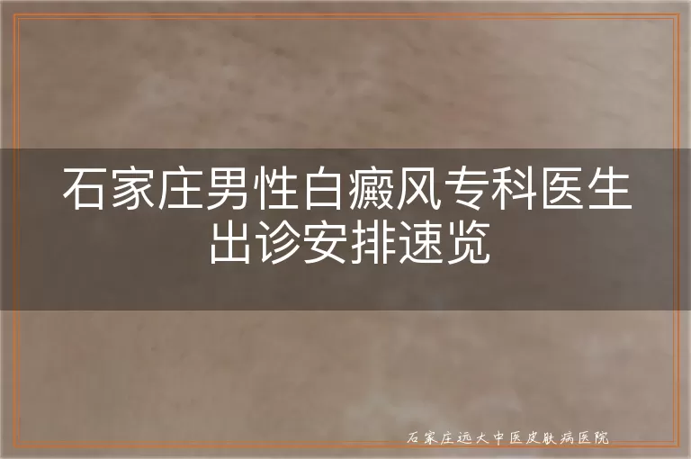 石家庄男性白癜风专科医生出诊安排速览