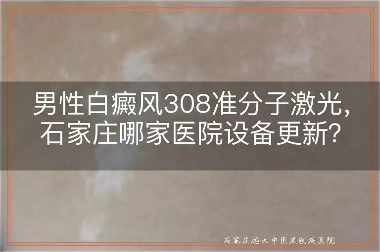 男性白癜风308准分子激光，石家庄哪家医院设备更新？