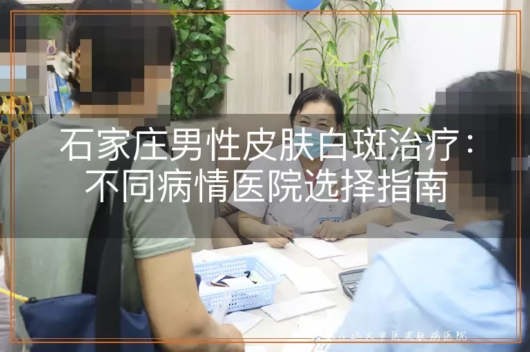 石家庄男性皮肤白斑治疗：不同病情医院选择指南