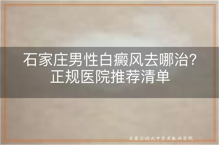 石家庄男性白癜风去哪治？正规医院推荐清单