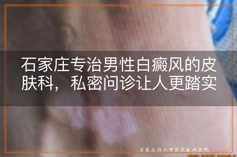 石家庄专治男性白癜风的皮肤科，私密问诊让人更踏实