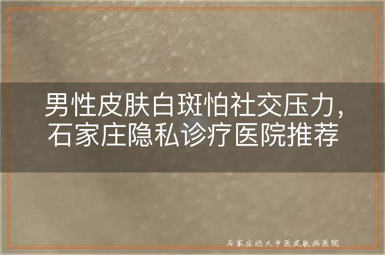 男性皮肤白斑怕社交压力，石家庄隐私诊疗医院推荐