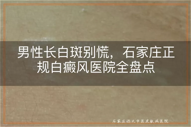 男性长白斑别慌，石家庄正规白癜风医院全盘点